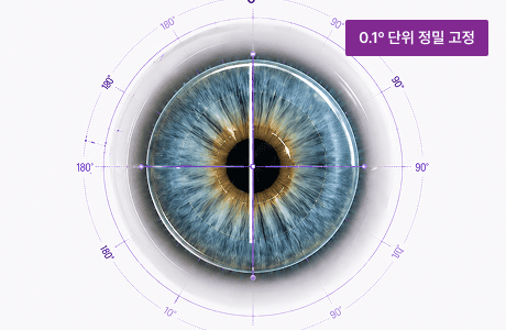 난시 축 정밀 정렬