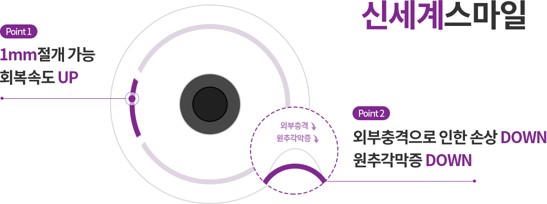 point1. 1mm 절개 가능 회복속도 UP, point2. 외부충격 up 원추각막증 down