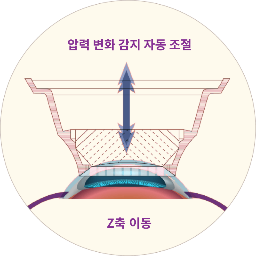 스마일프로 특장점